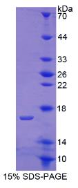 SDS-PAGE (COMP-5794H).jpg